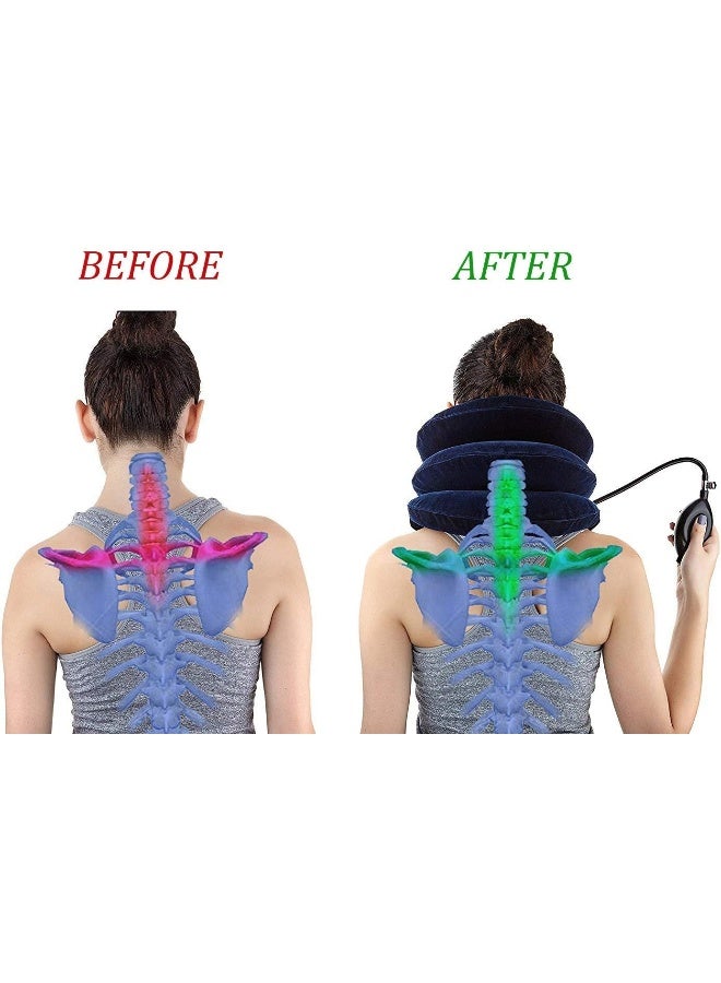 RUNZI Cervical Neck Traction Device Inflatable Neck Stretcher, Easy to Use for Chronic Neck and Shoulder Pain Relief, Neck Cervical Brace Collar Pillow - Image 3